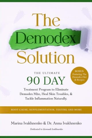 The Demodex Solution: The Ultimate 90 Day Treatment Program to Eliminate Demodex Mite, Heal Skin Troubles, &amp; Tackle Inflammation Naturally.(Kobo/電子書)