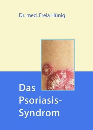 Das Psoriasis-Syndrom(Kobo/電子書)